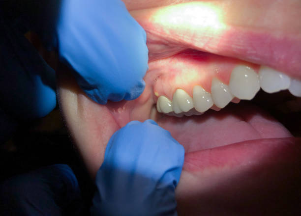 Best Teeth Whitening  in New Middletown, OH