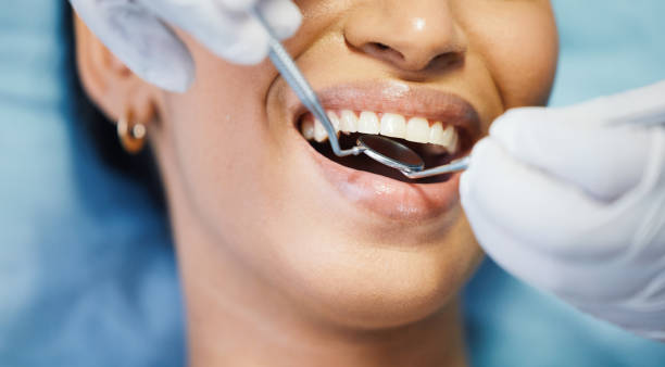 Best Teeth Whitening  in New Middletown, OH