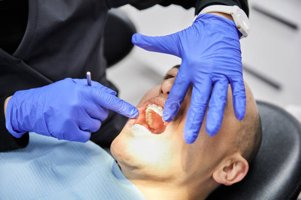 Best Dentist for Tooth Abscess  in New Middletown, OH